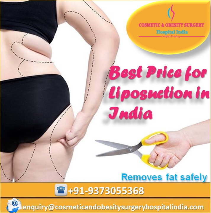 Best Price for Tummy Tuck Surgery in India